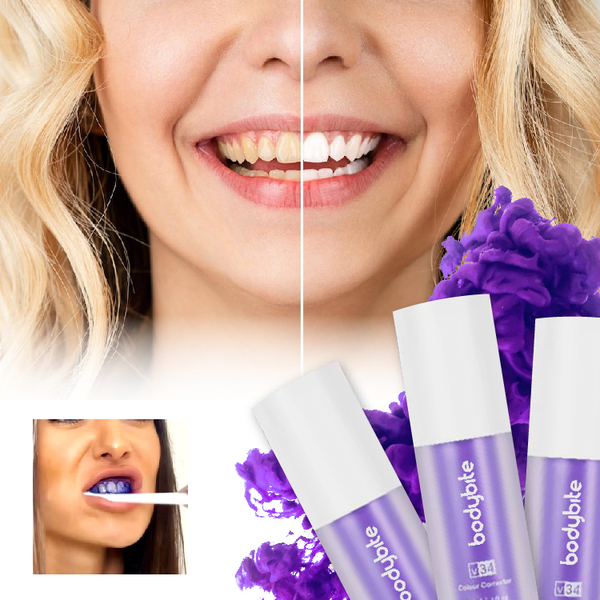 JOYTEETH_14.09.23_LILJANA_UPWORK_IMAGE_V2