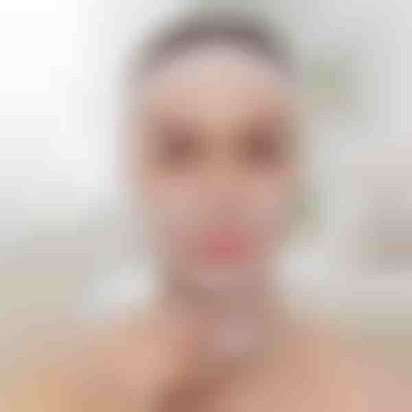 Veidą formuojanti pakėlimo juosta | KIMLIFT