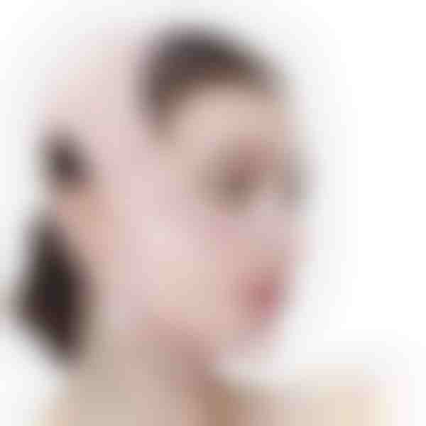 Juosta veido pakėlimui ir žandikaulio linijos formavimui | KIMLIFT